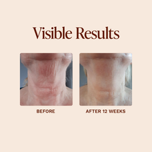 Load image into Gallery viewer, Vivier GrenzCine® Neck Anti-Aging Cream