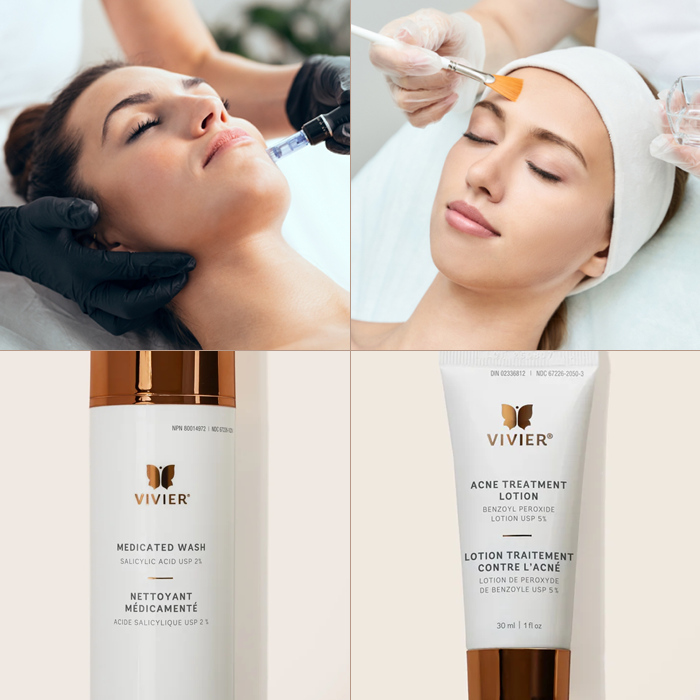 Acne Package