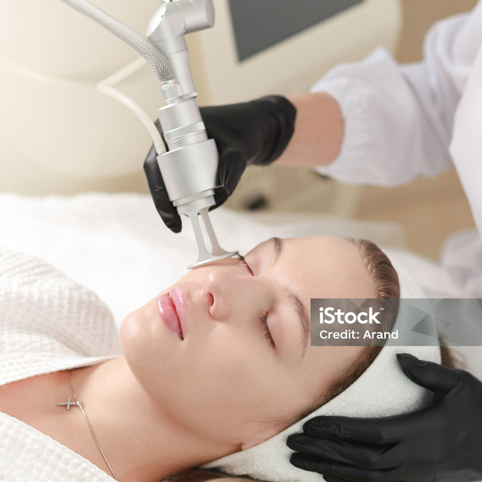 Acne Laser Facial