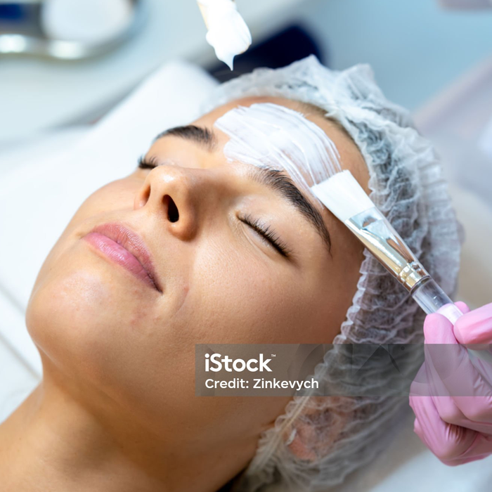 Chemical Peel (Vivier / Salicylic / Glycolic)