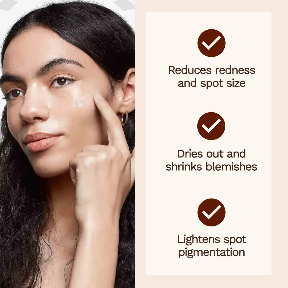 Shaant Spot Hero Pimple Gel