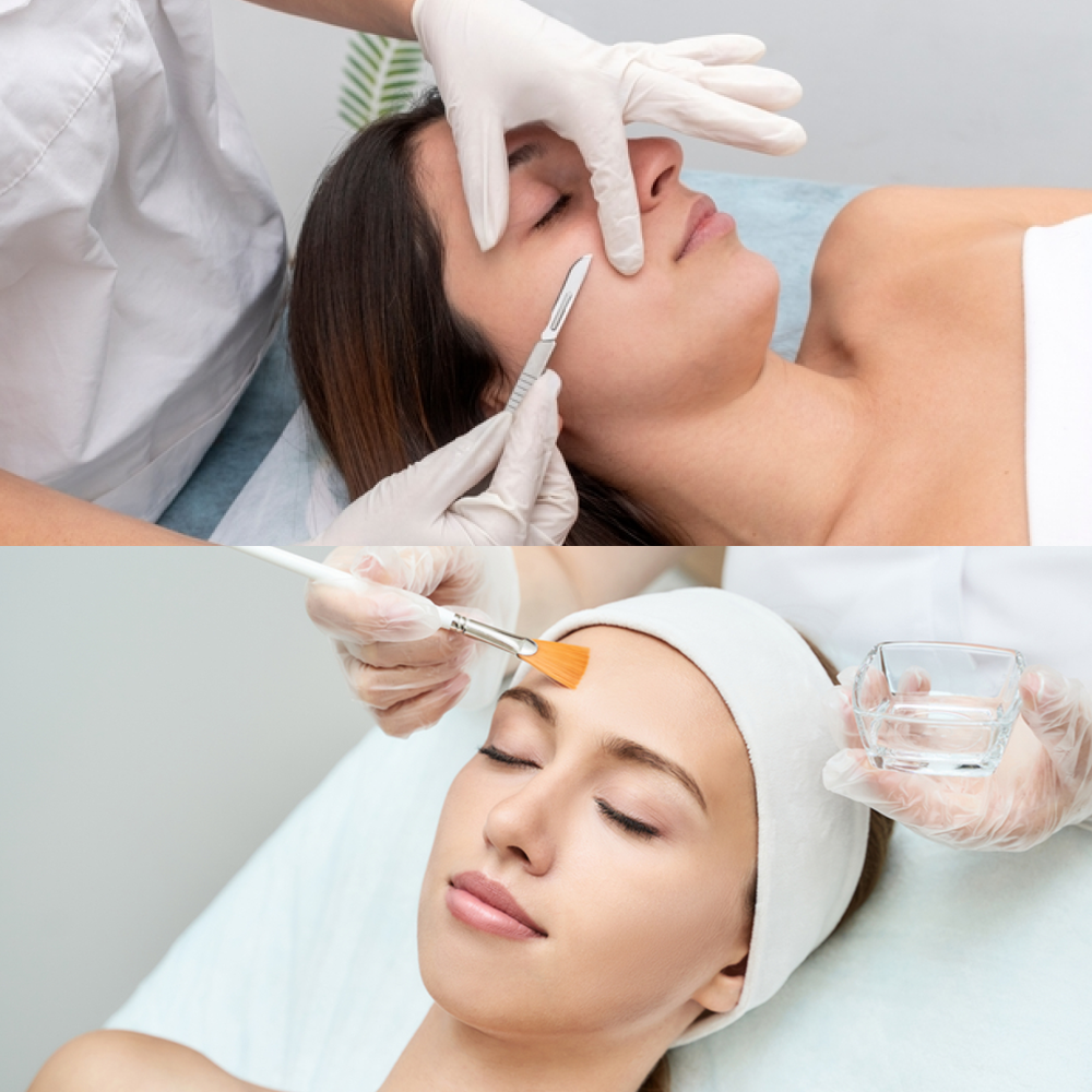Dermaplaning with Chemical Peel