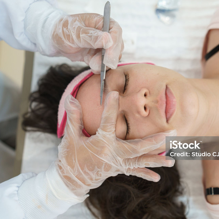 Dermaplaning