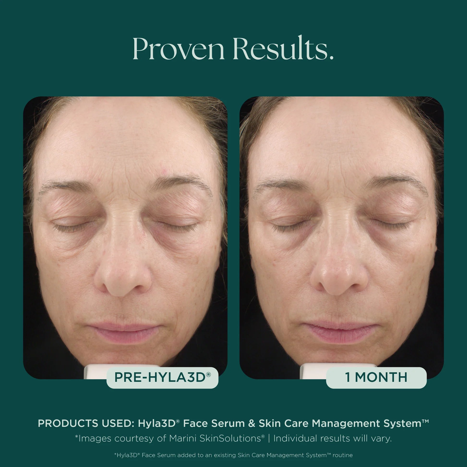 Hyla3D® Face Serum Hyaluronic Acid Complex