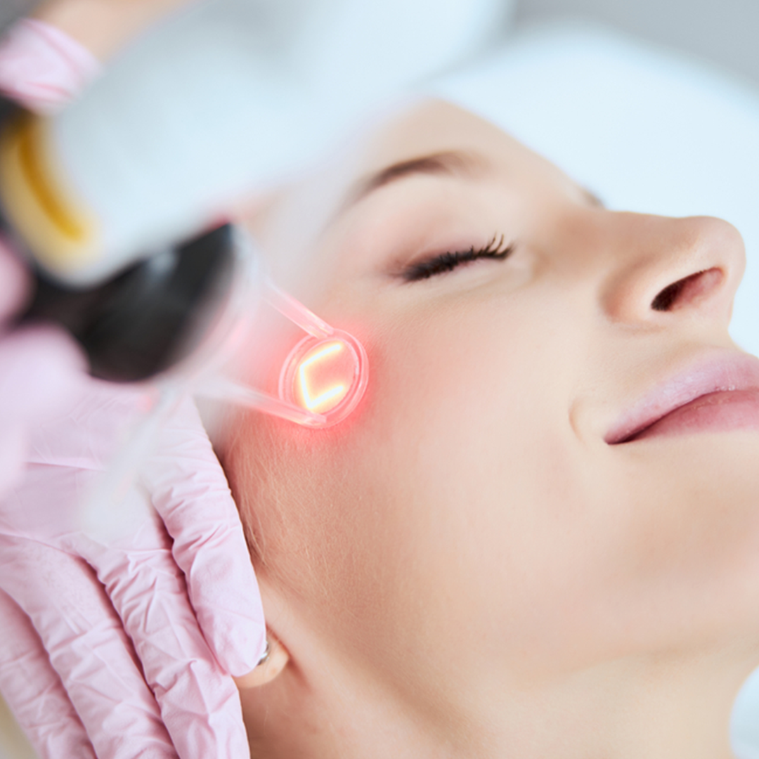 Erbium Lunch Time Laser Peel (Save 50%)
