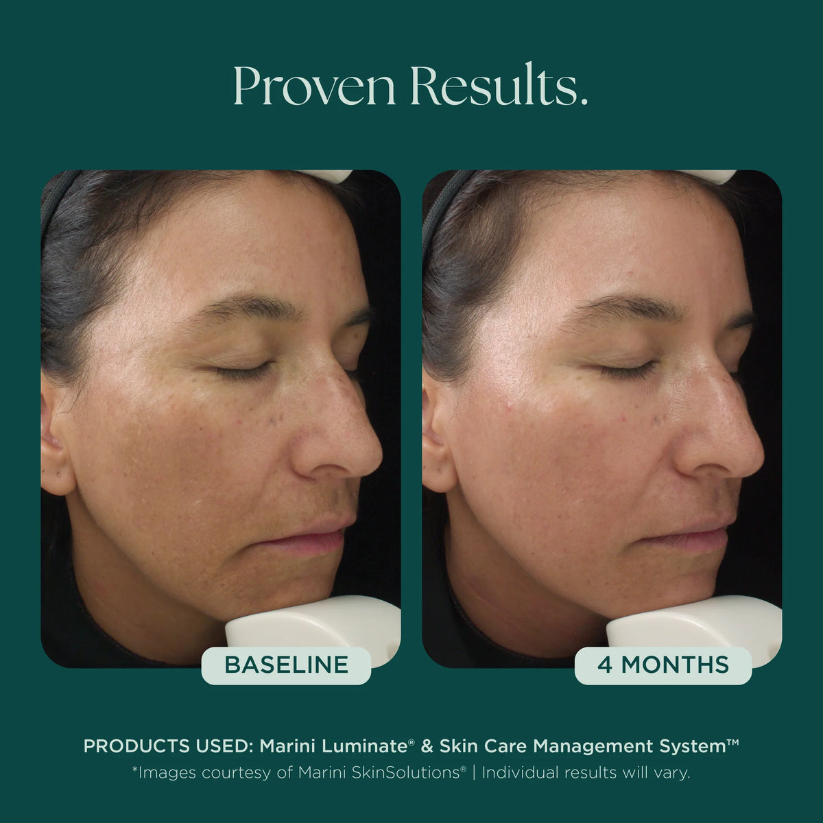 Marini Luminate® Face Lotion