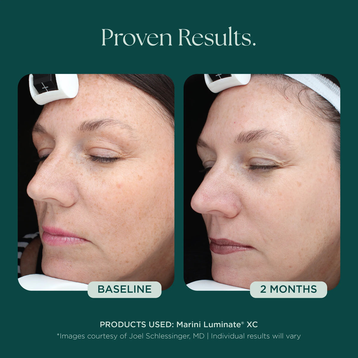 Marini Luminate® Face Lotion