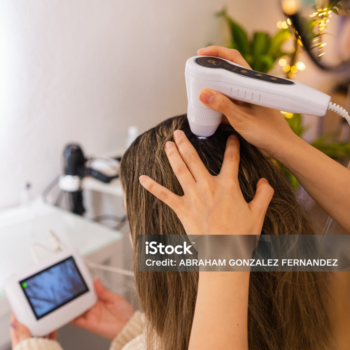 Meso Cocktail & Exosomes Hair Restoration (Innoaesthetics)