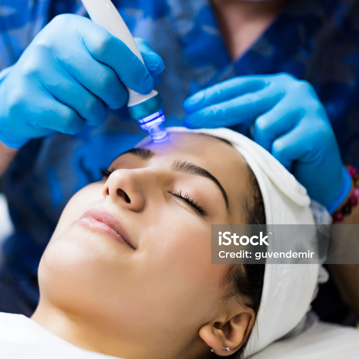 Microdermabrasion