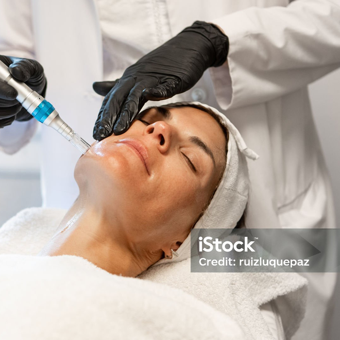 Microneedling Meso Facial