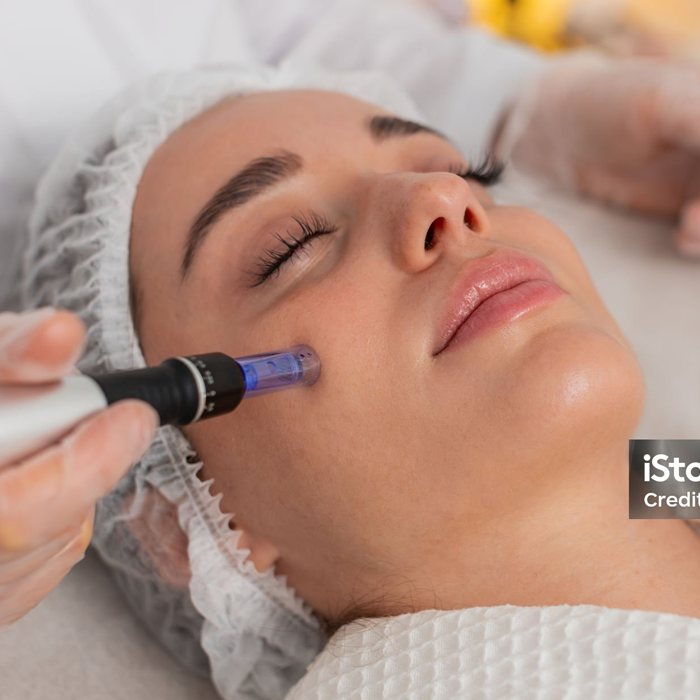 Microneedling