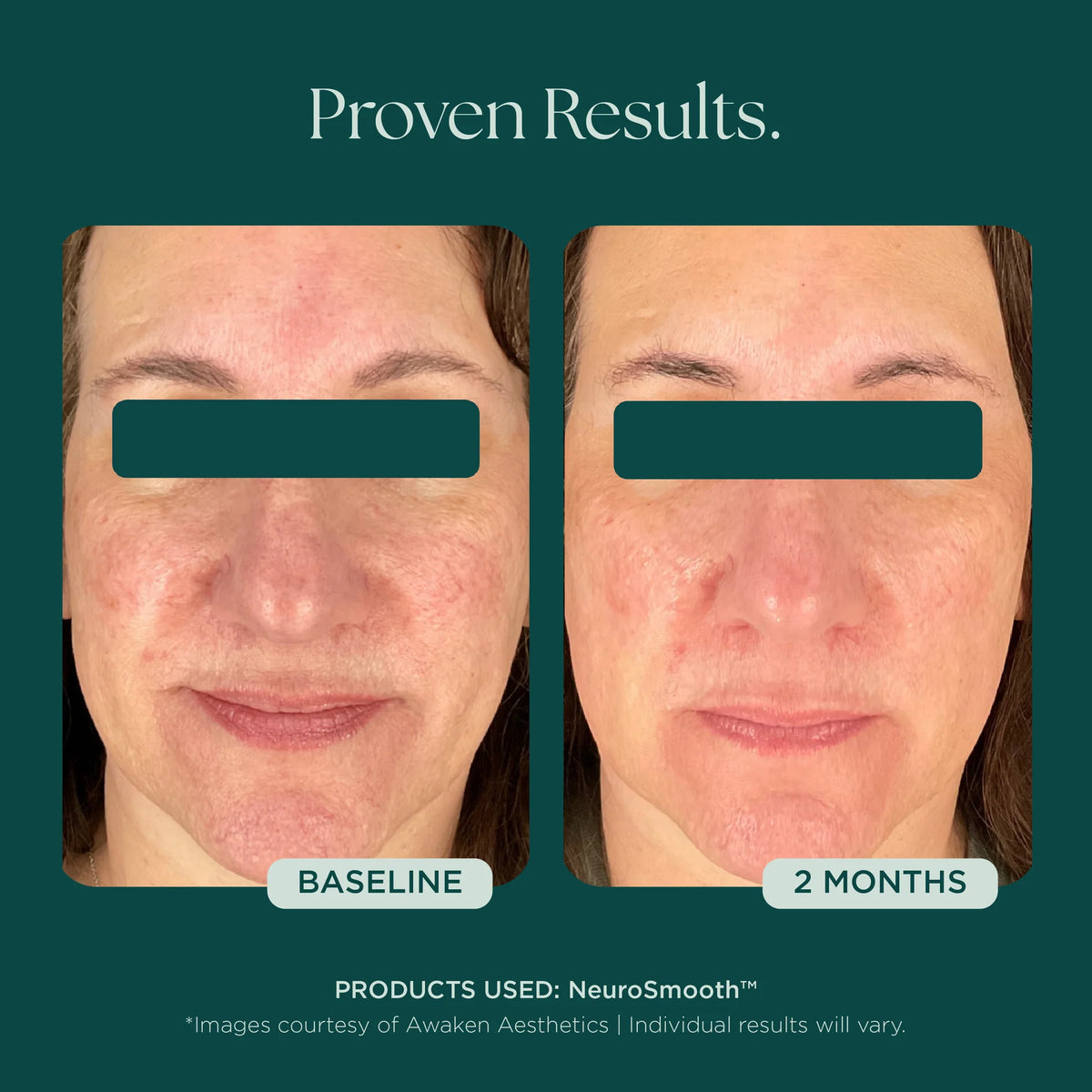 NeuroSmooth® Face Serum
