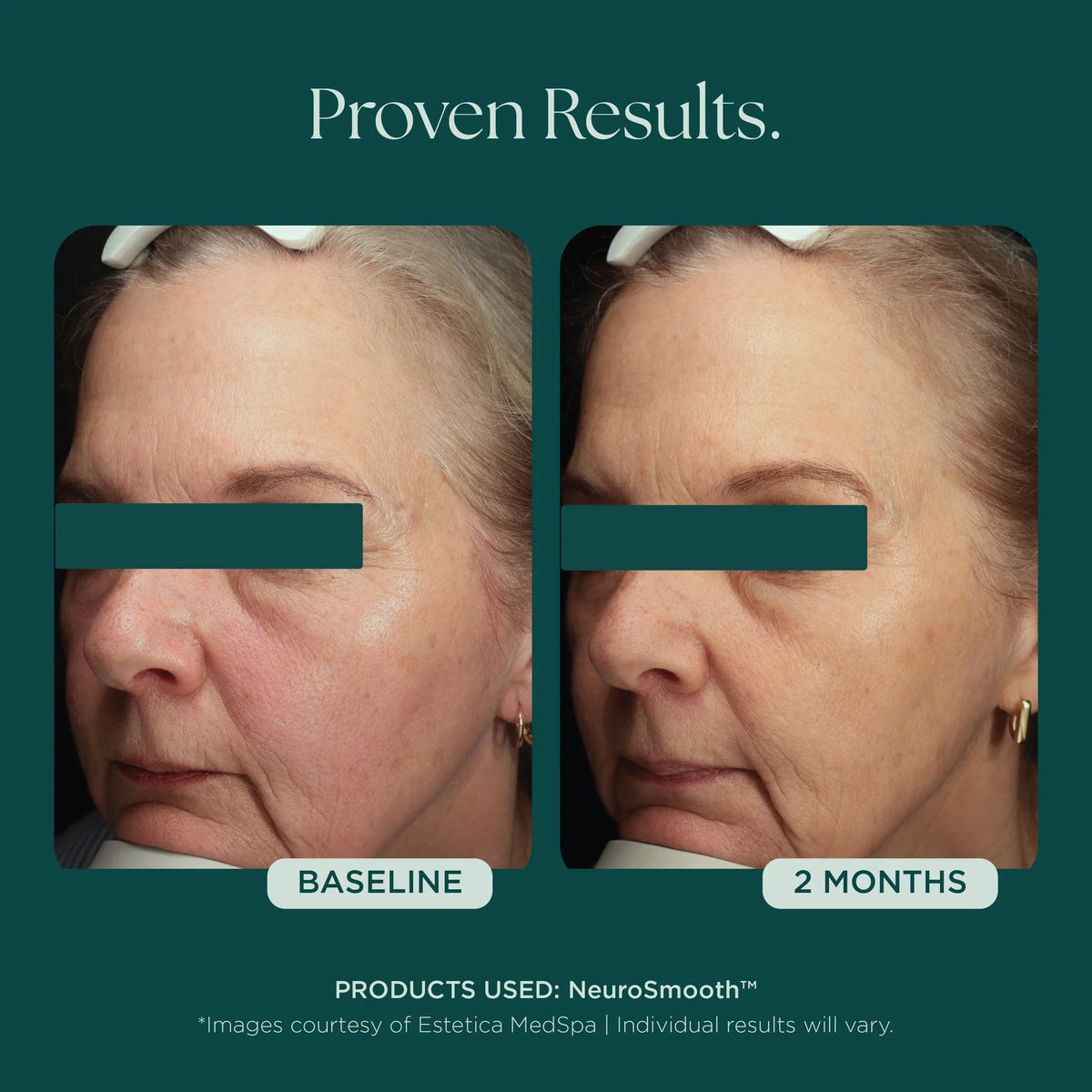 NeuroSmooth® Face Serum