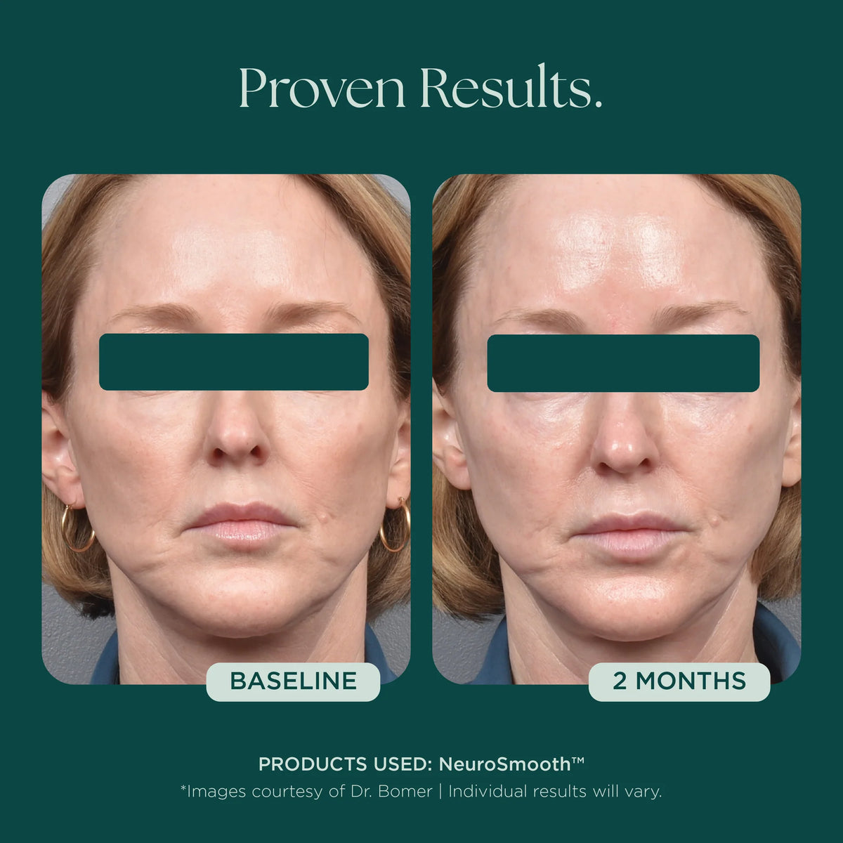 NeuroSmooth® Face Serum
