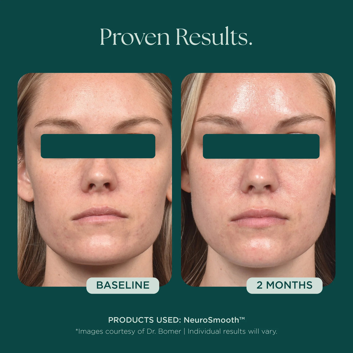NeuroSmooth® Face Serum