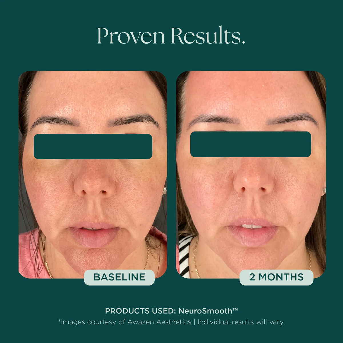 NeuroSmooth® Face Serum