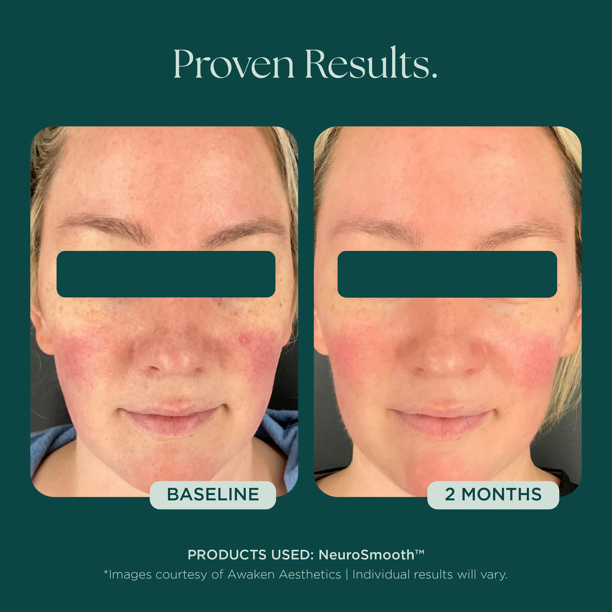 NeuroSmooth® Face Serum
