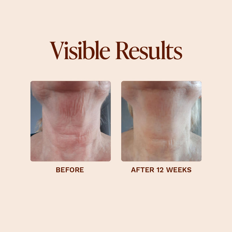GrenzCine Neck - Firming Neck Cream | Vivier