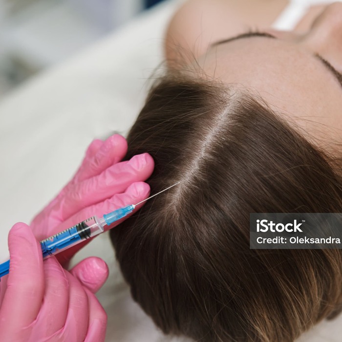 Injectables - PRP Hair Restoration