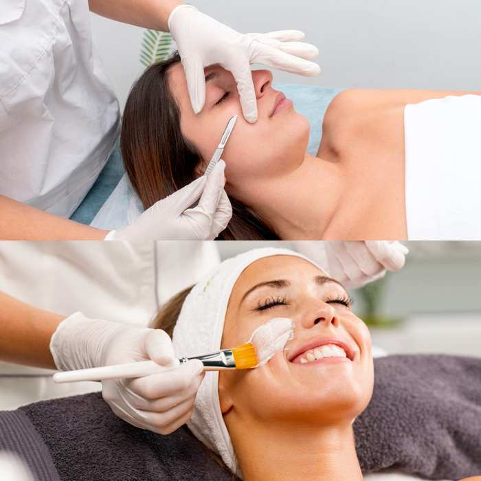[BOGO] - Dermaplaning with Chemical Peel