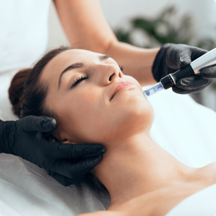 Microdermabrasion