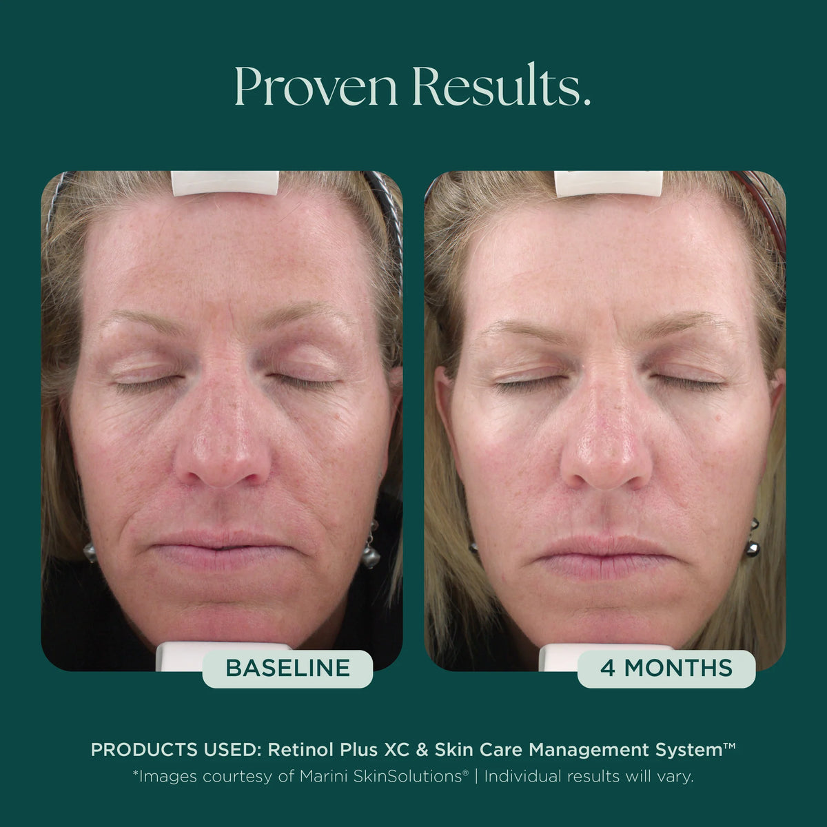Retinol Plus