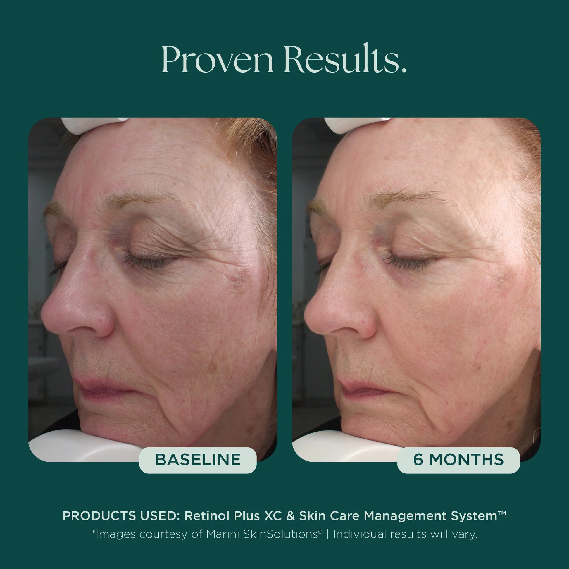 Retinol Plus XC