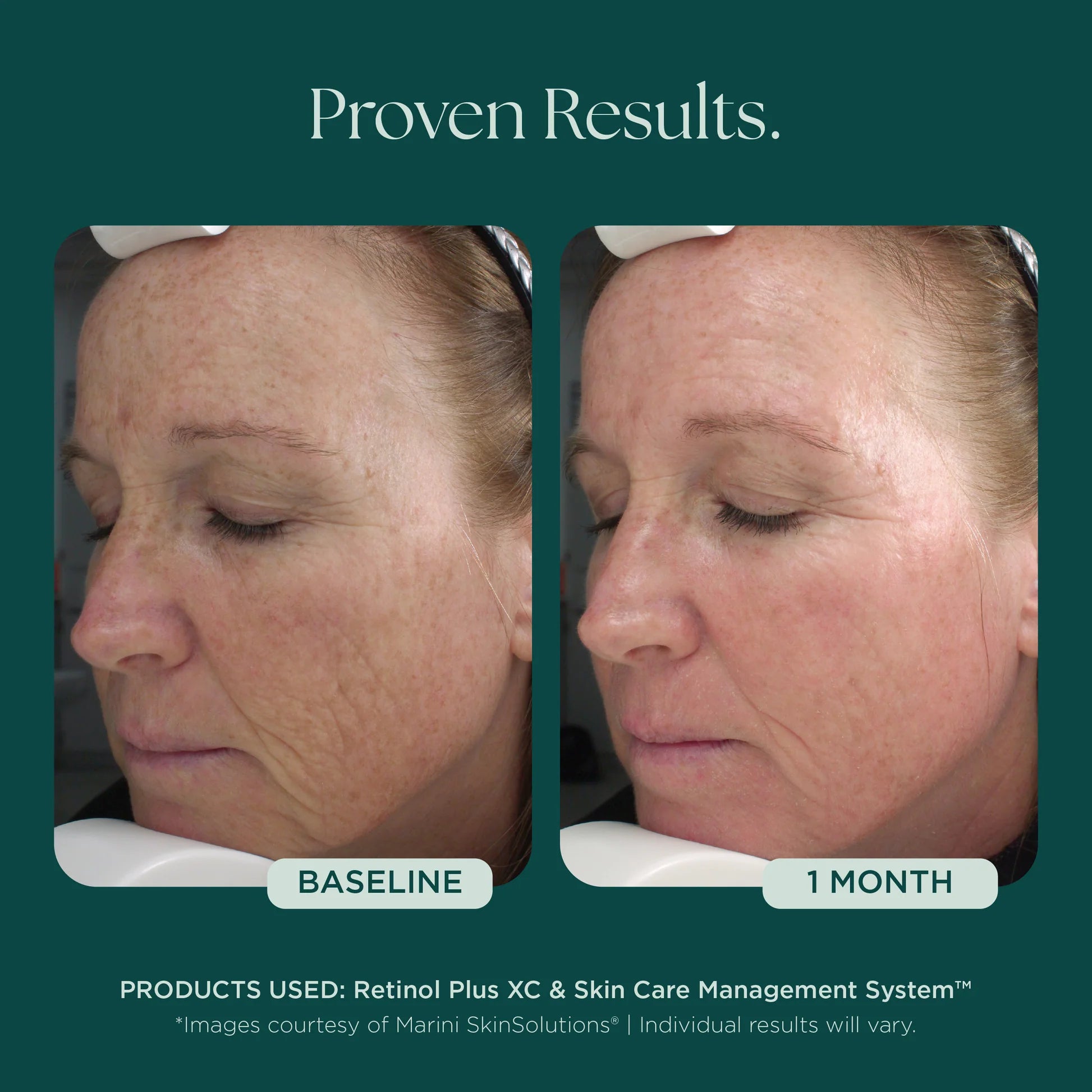 Retinol Plus XC