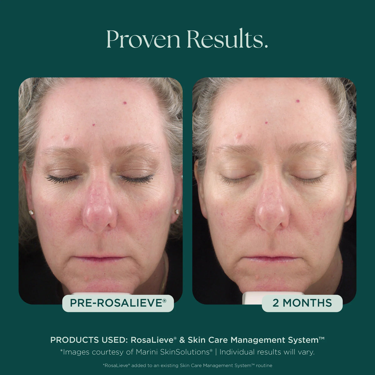 RosaLieve Redness Reducing Complex