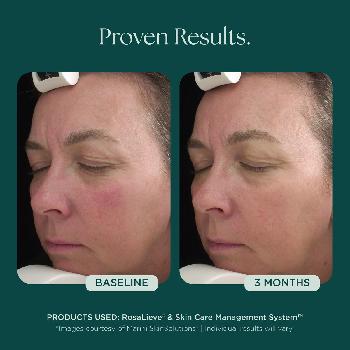 RosaLieve Redness Reducing Complex
