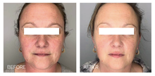 Load image into Gallery viewer, Signature Facial
