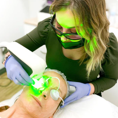 Yellow Laser Scan + Microneedling