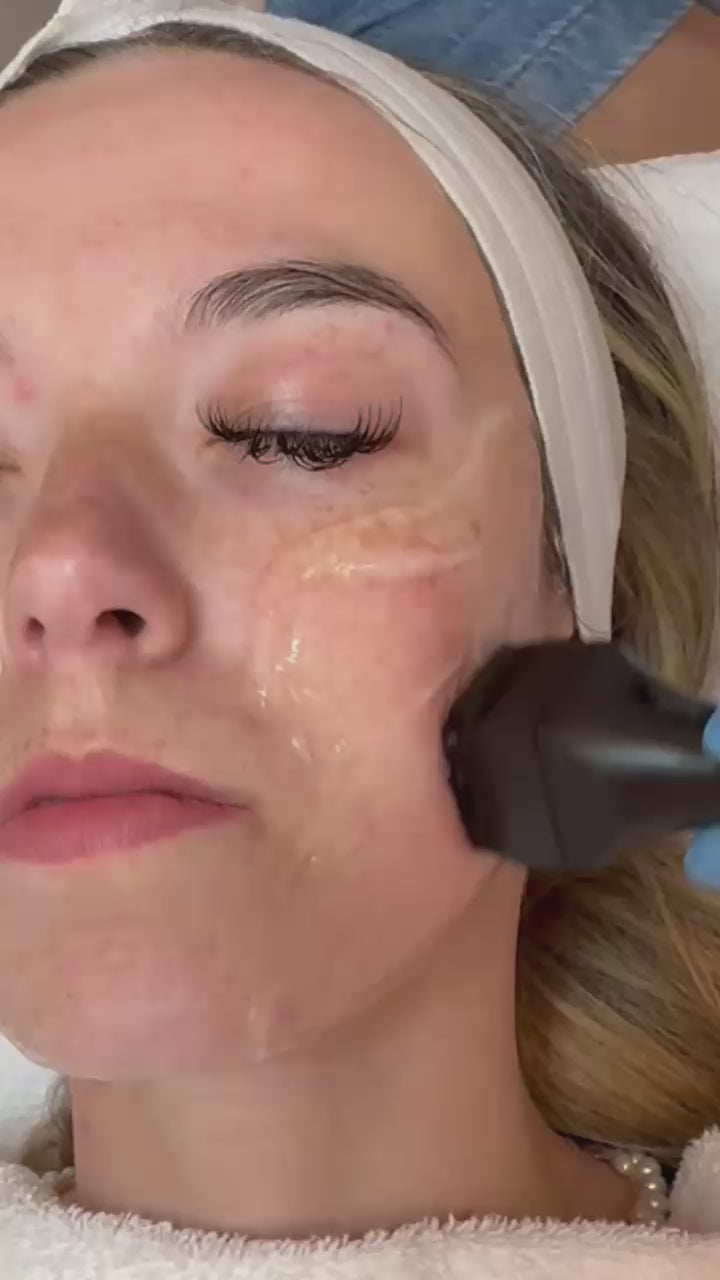 Skin Boost Facial — Exfoliate. Hydrate. Tighten.